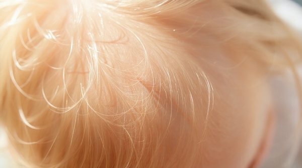 Le guide essentiel pour maîtriser la formation pédiculose